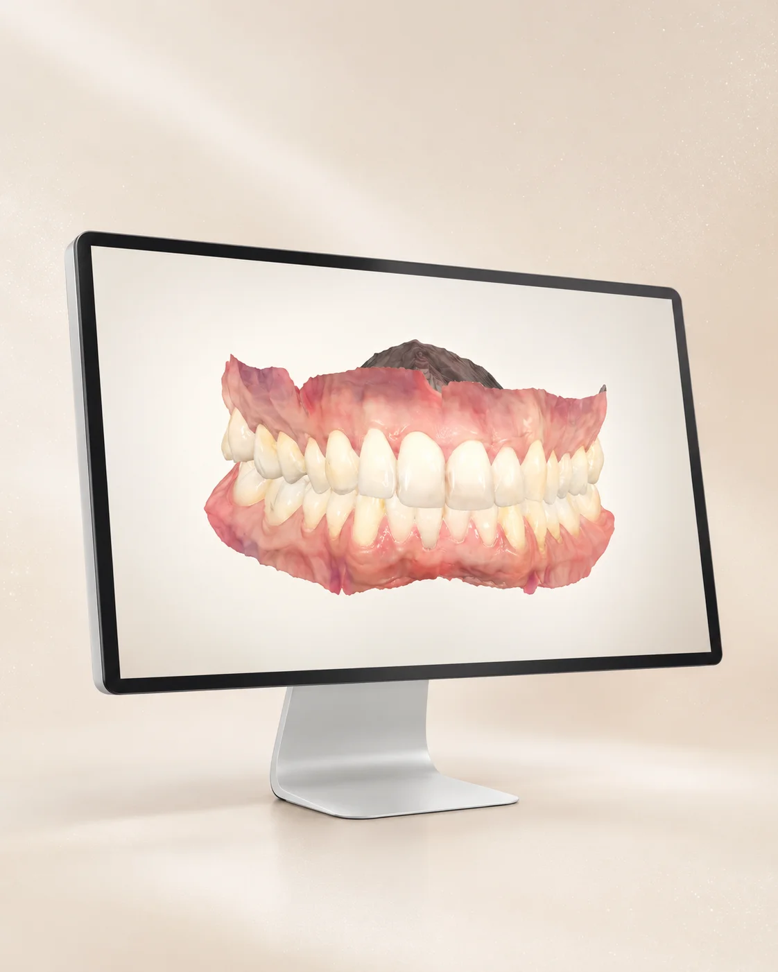 Digital X-ray scan review at Glow Dental